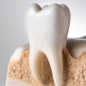 Jak wygląda ząb do leczenia kanałowego?